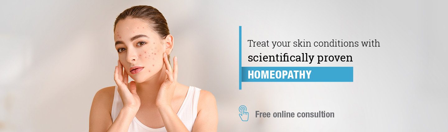 treat skin condition with homeopathy