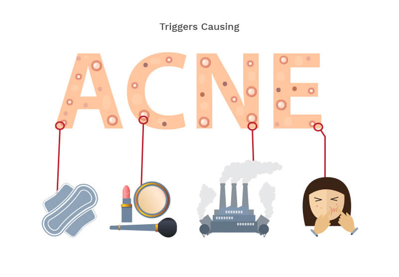 acne-causes3