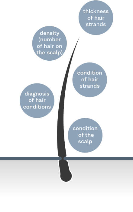 hairloss_diagnosis